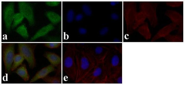 STAT5 alpha/beta Antibody in Immunocytochemistry (ICC/IF)