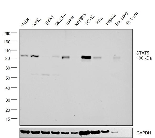 STAT5 alpha/beta Antibody in Western Blot (WB)