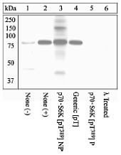 Phospho-c-Kit (Tyr703) Antibody in Western Blot (WB)