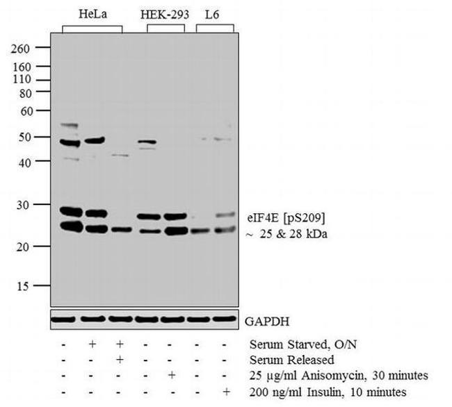 Phospho-eIF4E (Ser209) Antibody