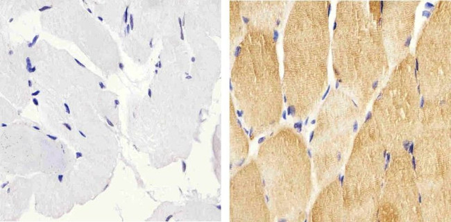 Phospho-HSP27 (Ser82) Antibody in Immunohistochemistry (Paraffin) (IHC (P))