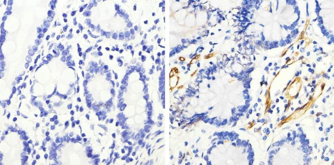 Phospho-HSP27 (Ser82) Antibody in Immunohistochemistry (Paraffin) (IHC (P))