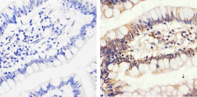 Phospho-Rb (Thr826) Antibody in Immunohistochemistry (Paraffin) (IHC (P))