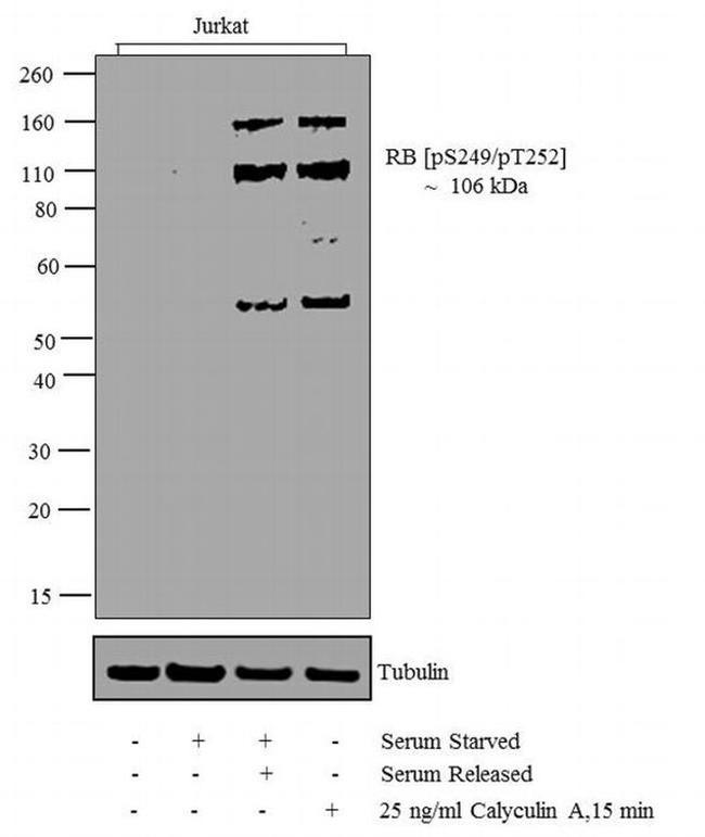 Phospho-Rb (Ser249, Thr252) Antibody in Western Blot (WB)