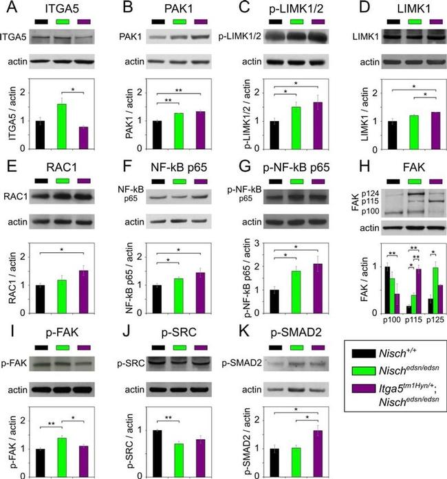 Phospho-FAK (Tyr576) Antibody in Western Blot (WB)