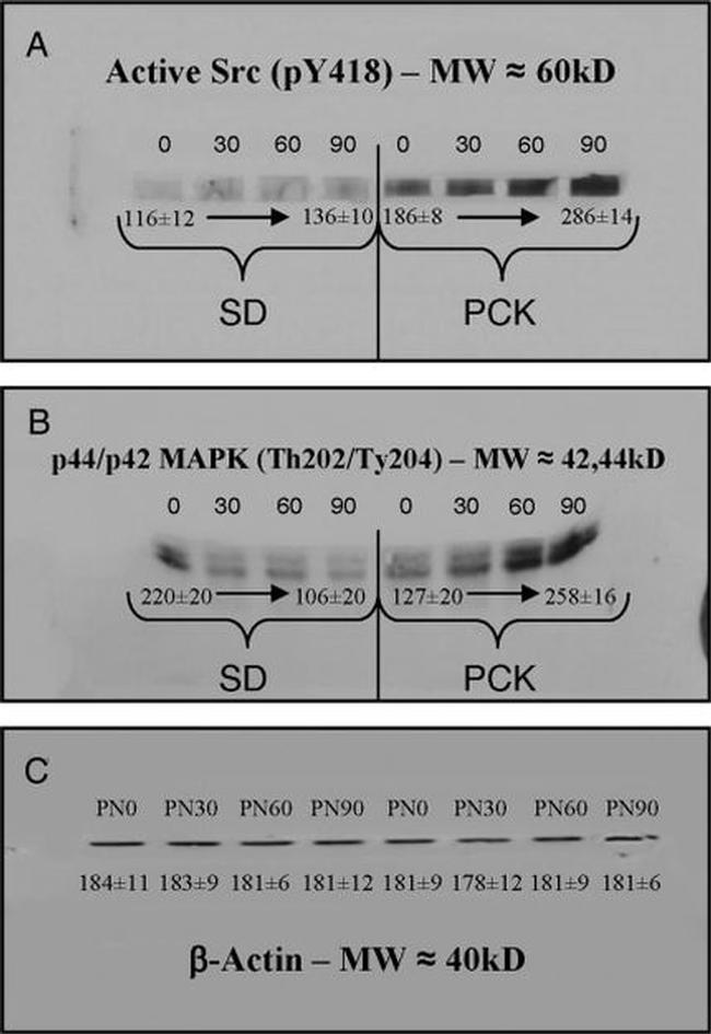 SRC Antibody in Immunoprecipitation (IP)