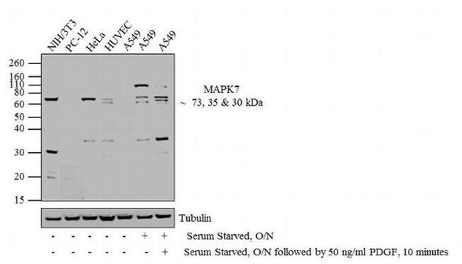 ERK5 Antibody in Western Blot (WB)