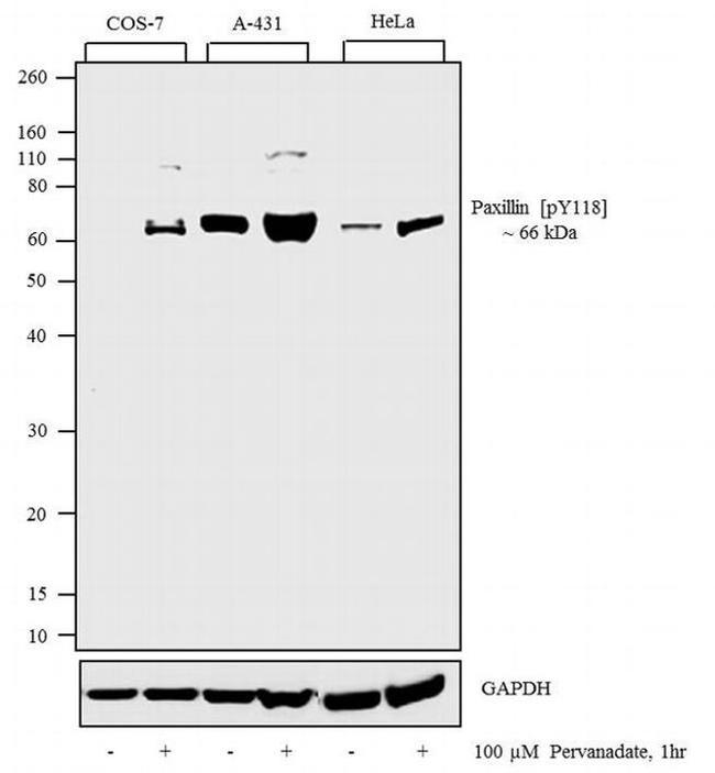 Phospho-Paxillin (Tyr118) Antibody in Western Blot (WB)