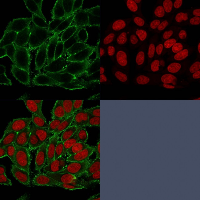 Moesin Antibody in Immunocytochemistry (ICC/IF)