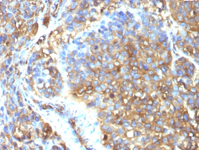 Moesin Antibody in Immunohistochemistry (Paraffin) (IHC (P))