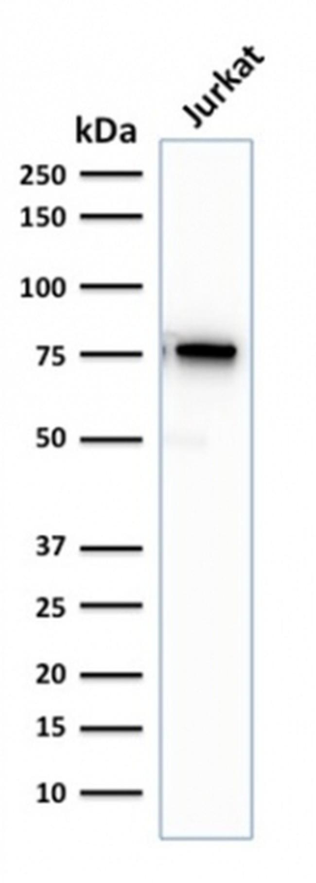 Moesin Antibody in Western Blot (WB)