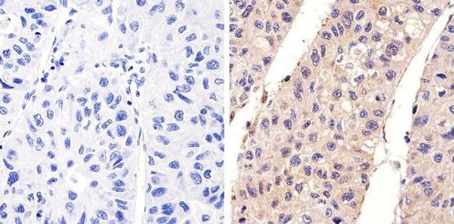 Phospho-EGFR (Tyr1173) Antibody in Immunohistochemistry (Paraffin) (IHC (P))