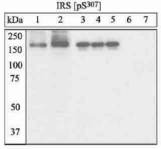 Phospho-IRS1 (Ser307) Antibody in Western Blot (WB)