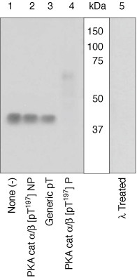 Phospho-PKC beta-2 (Thr641) Antibody in Western Blot (WB)