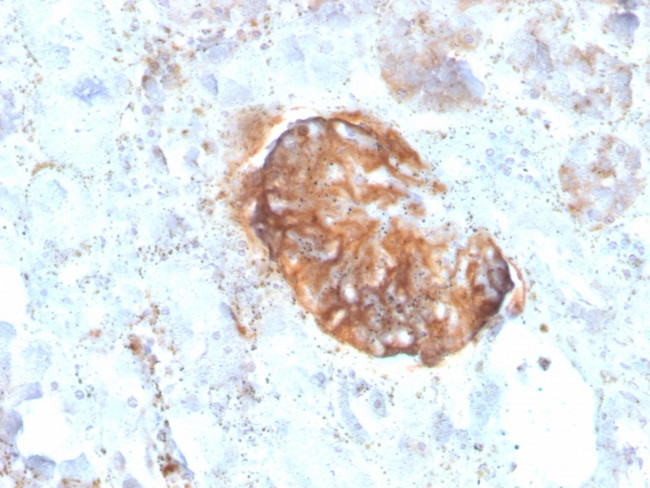 MTAP Antibody in Immunohistochemistry (Paraffin) (IHC (P))