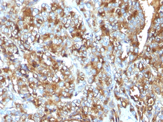 MUC1/CA15-3/EMA/CD227 (Epithelial Marker) Antibody in Immunohistochemistry (Paraffin) (IHC (P))