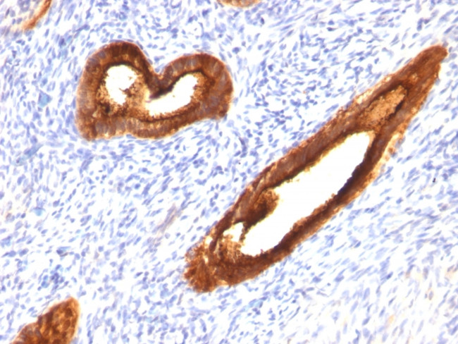 MUC1/CA15-3/EMA/CD227 (Epithelial Marker) Antibody in Immunohistochemistry (Paraffin) (IHC (P))