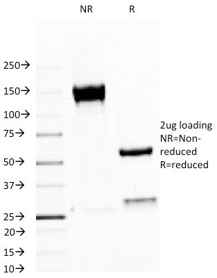 MUC1/CA15-3/EMA/CD227 (Epithelial Marker) Antibody in SDS-PAGE (SDS-PAGE)