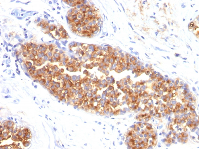 MUC1/CA15-3/EMA/CD227 (Epithelial Marker) Antibody in Immunohistochemistry (Paraffin) (IHC (P))