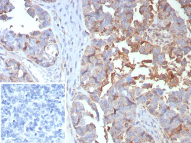 MX1/MX dynamin like GTPase 1 Antibody in Immunohistochemistry (Paraffin) (IHC (P))