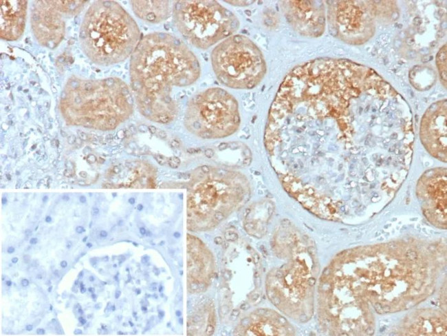 MX1/MX dynamin like GTPase 1 Antibody in Immunohistochemistry (Paraffin) (IHC (P))