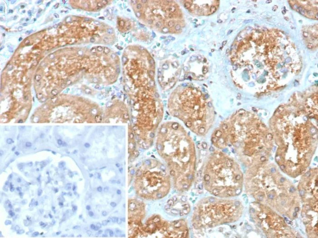 MX1/MX dynamin like GTPase 1 Antibody in Immunohistochemistry (Paraffin) (IHC (P))