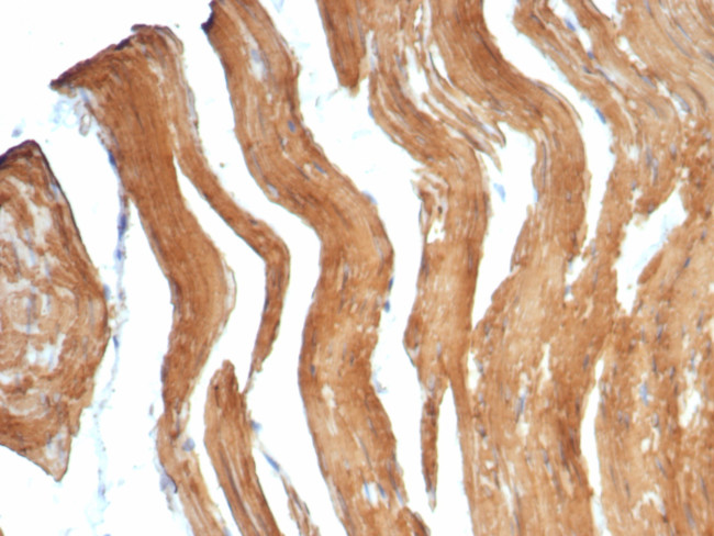Smooth Muscle Myosin Heavy Chain (SM-MHC) (Leiomyosarcoma and Myoepithelial Cell Marker) Antibody in Immunohistochemistry (Paraffin) (IHC (P))
