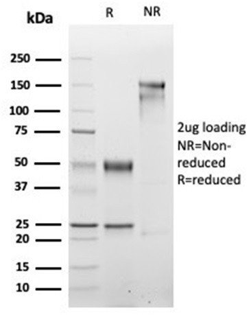 Myogenin/Myf-4 (Skeletal Muscle Marker) Antibody in SDS-PAGE (SDS-PAGE)