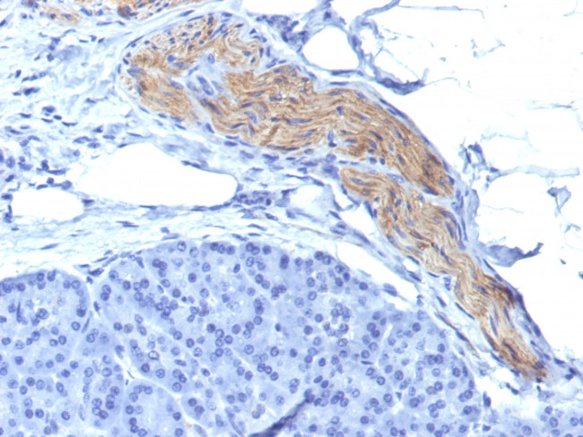 CD56/NCAM1/NKH1 Antibody in Immunohistochemistry (Paraffin) (IHC (P))