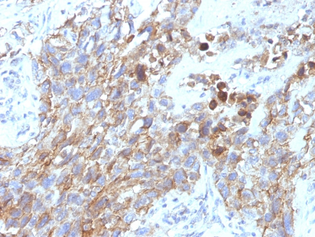 CD56/NCAM1/NKH1 Antibody in Immunohistochemistry (Paraffin) (IHC (P))