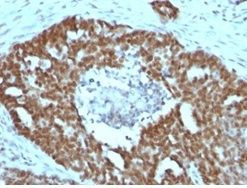 Nucleolin Antibody in Immunohistochemistry (Paraffin) (IHC (P))