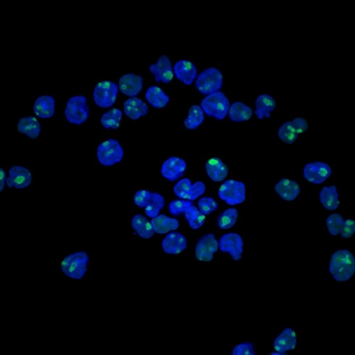 Nucleolin Antibody in Immunocytochemistry (ICC/IF)