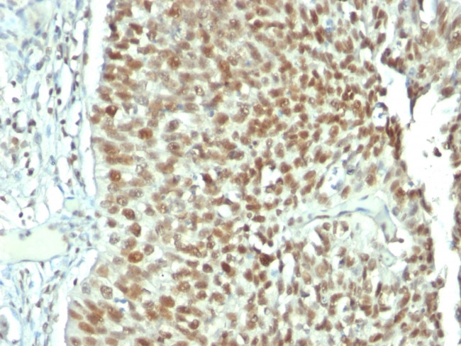 Nucleolin Antibody in Immunohistochemistry (Paraffin) (IHC (P))