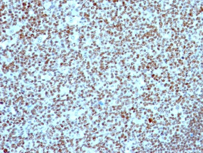 Nucleolin Antibody in Immunohistochemistry (Paraffin) (IHC (P))