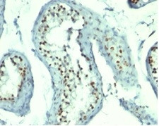 Nucleolin (Marker of Human Cells) Antibody in Immunohistochemistry (Paraffin) (IHC (P))