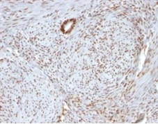 Nucleolin (Marker of Human Cells) Antibody in Immunohistochemistry (Paraffin) (IHC (P))