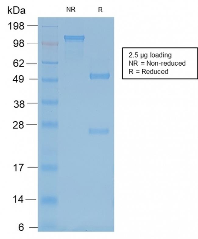 Neurofilament Antibody in SDS-PAGE (SDS-PAGE)