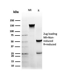 NFIA/NF1A (Nuclear Factor 1A) (Transcription Factor) Antibody in SDS-PAGE (SDS-PAGE)
