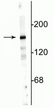 NMDAR2A Polyclonal Antibody (480031)