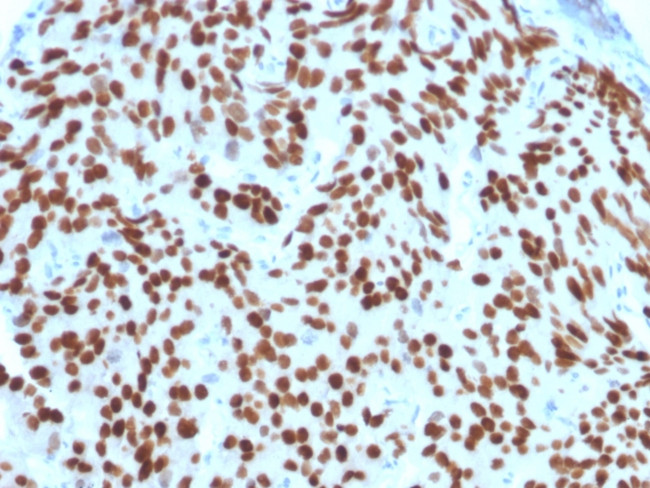 NKX3.1 Antibody in Immunohistochemistry (Paraffin) (IHC (P))