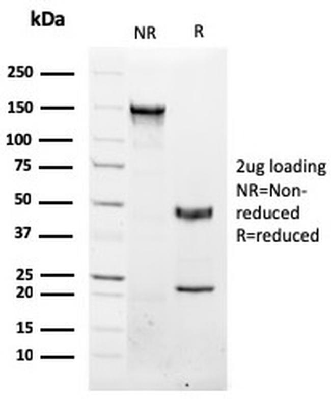 NKX3.1 Antibody in SDS-PAGE (SDS-PAGE)