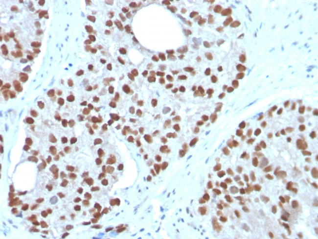 NKX3.1 Antibody in Immunohistochemistry (Paraffin) (IHC (P))