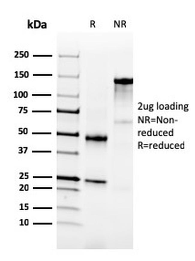 NKX3.1 Antibody in SDS-PAGE (SDS-PAGE)