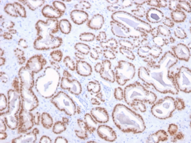 NKX3.1 Antibody in Immunohistochemistry (Paraffin) (IHC (P))