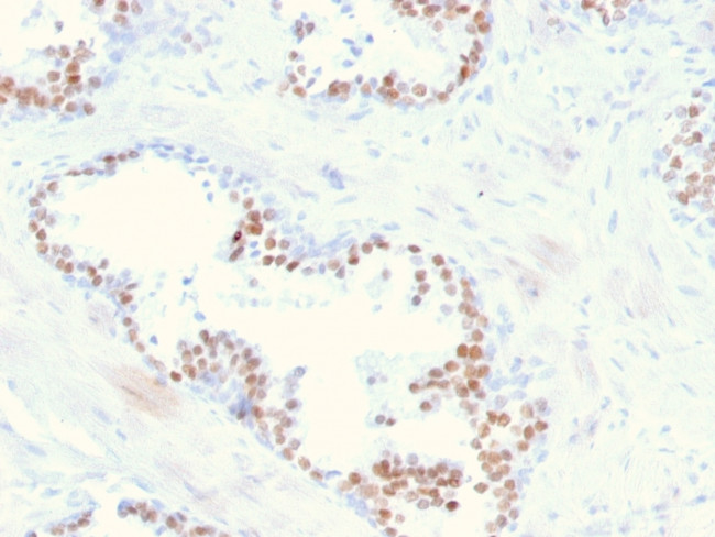 NKX3.1 Antibody in Immunohistochemistry (Paraffin) (IHC (P))