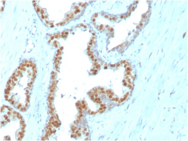 NKX3.1 (Metastatic Prostate Adenocarcinoma Marker) Antibody in Immunohistochemistry (Paraffin) (IHC (P))