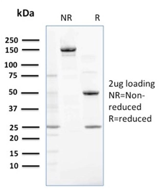 NME2/nm23-H2/NDPK-B (Suppressor of Metastasis) Antibody in SDS-PAGE (SDS-PAGE)