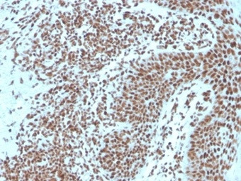 Nucleophosmin (Acute Myeloid Leukemia Marker) Antibody in Immunohistochemistry (Paraffin) (IHC (P))