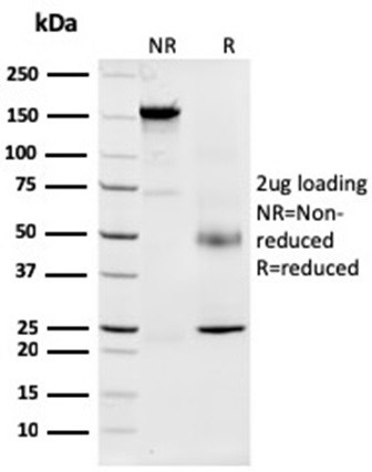 Nucleophosmin (Acute Myeloid Leukemia Marker) Antibody in SDS-PAGE (SDS-PAGE)