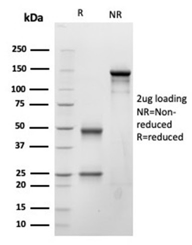 Natriuretic Peptide B/NPPB Antibody in SDS-PAGE (SDS-PAGE)